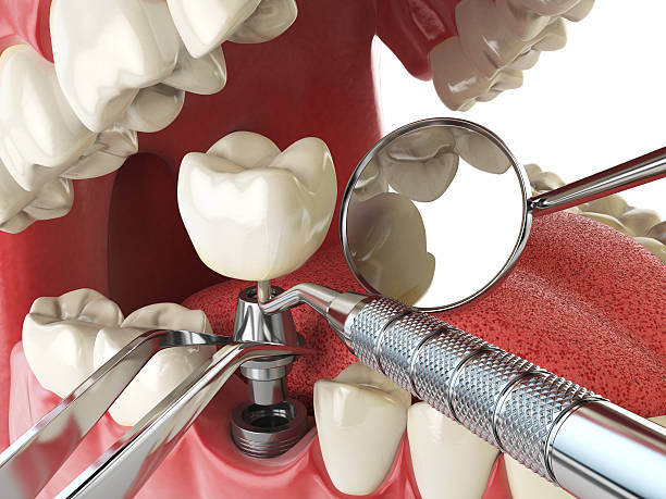 Best Emergency Dentist for Special Needs Patients in Agoura Hills, CA